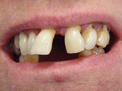 case-study-jacky-before-treatment Case Study - Jacky before her treatment