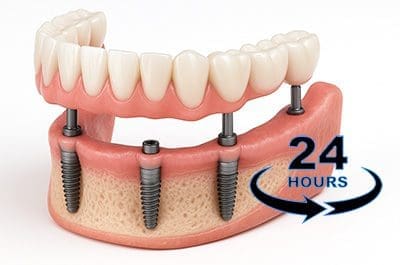 Explore same day teeth at North Street Dental